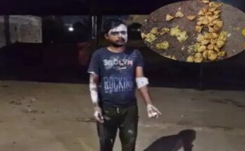 When the drunkard asked for money for the samosas, he poured boiling oil on the businessman, two got burnt