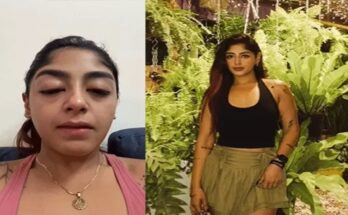 Splitsvilla Contestant Preet Singh Alleges Assault: Broken Tooth, Swollen Eyes