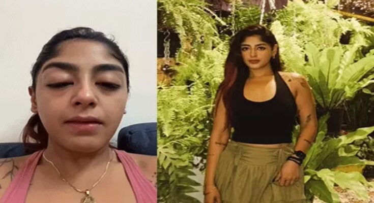 Splitsvilla Contestant Preet Singh Alleges Assault: Broken Tooth, Swollen Eyes